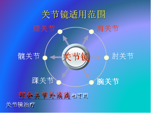 肩关节镜手术报销比例 关节镜检查医保