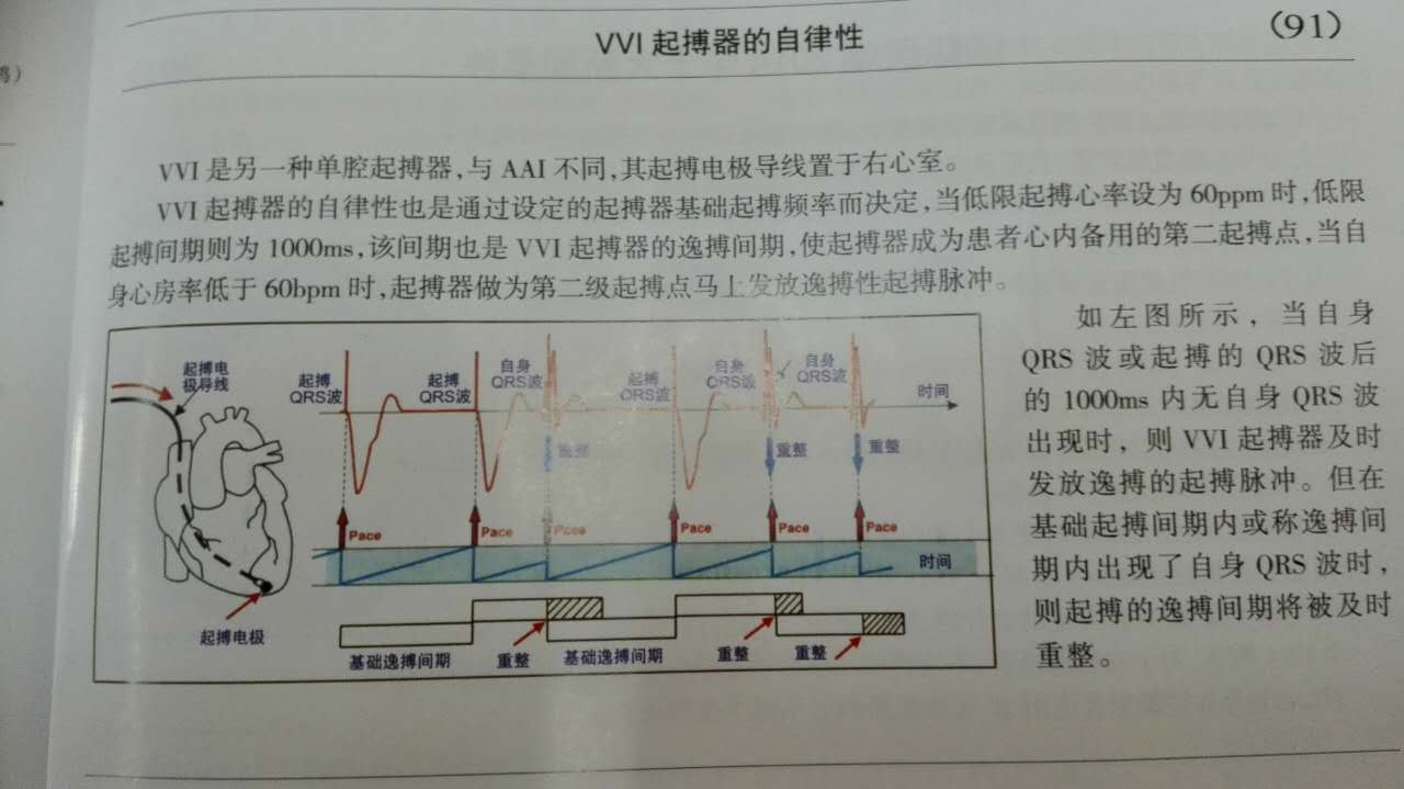 一图解概念AAI及VVI起搏器的自律性