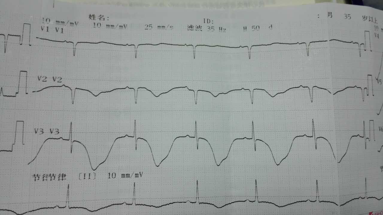 孤独患者五线谱