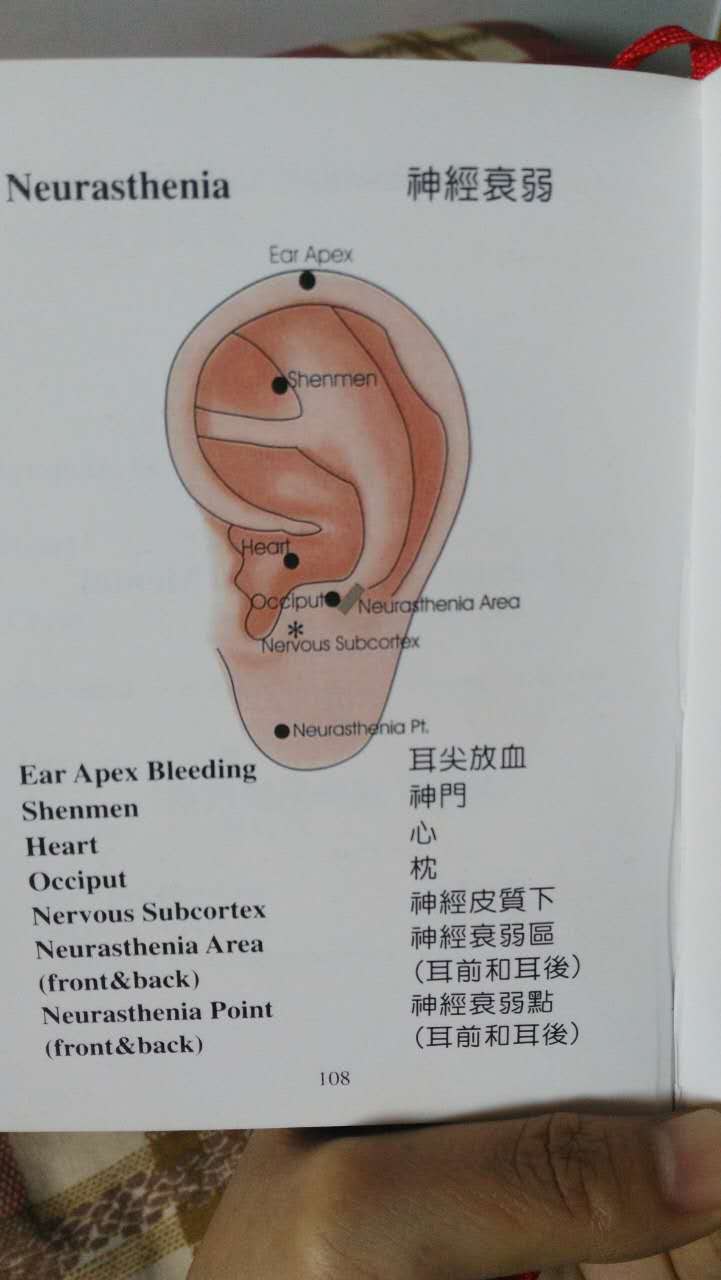 耳穴疗法治失眠棒棒哒!