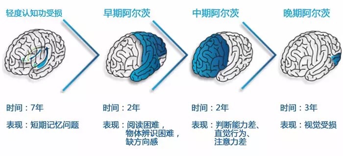 蛋白矫正沙发原理是什么_蛋白线是什么样子图片