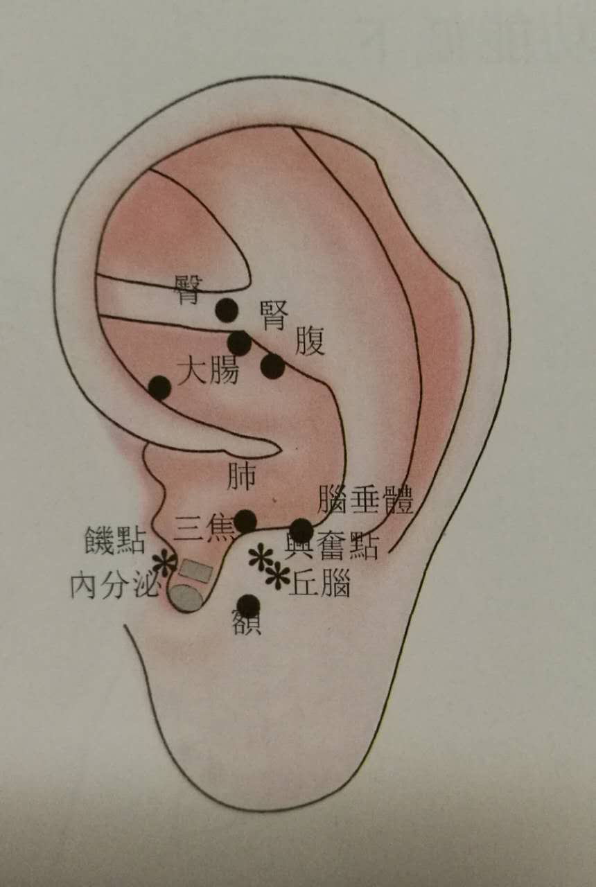 健康管理从控制体重做起!神奇的耳穴疗法助你一臂之力!