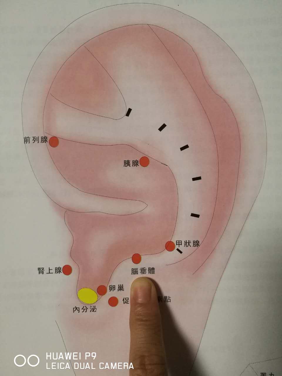 健康管理从控制体重做起!神奇的耳穴疗法助你一臂之力!