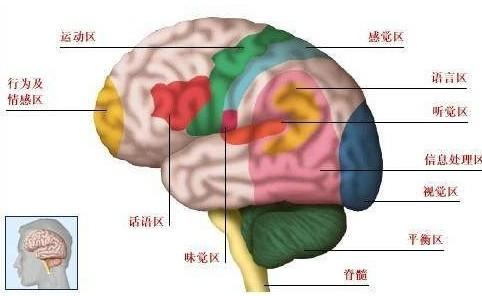 脑出血是指非外伤性脑实质内血管破裂引起的出血,最常见的病因是高