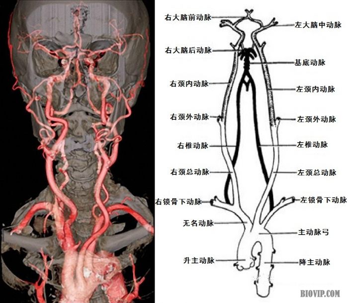 患者由外院诊断为椎基底动脉多发狭窄转至北京,于北京某医院门诊就诊