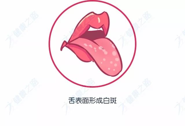 2, 乳白色舌头 口腔黏膜角化