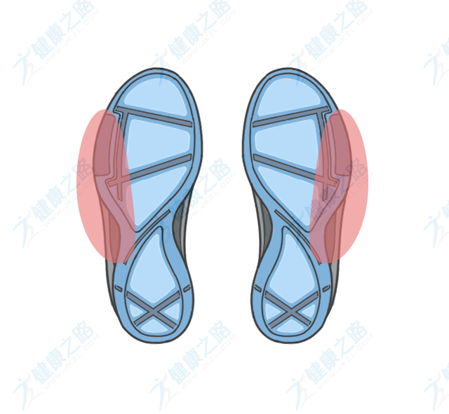从鞋底磨损竟能辨疾病!快对照看看你的鞋底磨损正常吗?