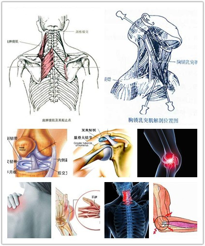 肩周炎;第三腰椎横突综合征;骨性关节炎;颈椎病;项韧带损伤;胸锁乳突