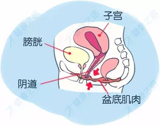 要知道,盆底肌的作用可不容小觑会造成膀胱逼尿肌,尿道括约肌和盆底肌