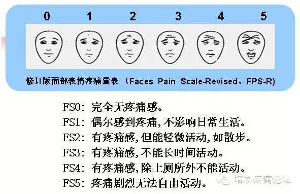 疼痛评分4种方法图片