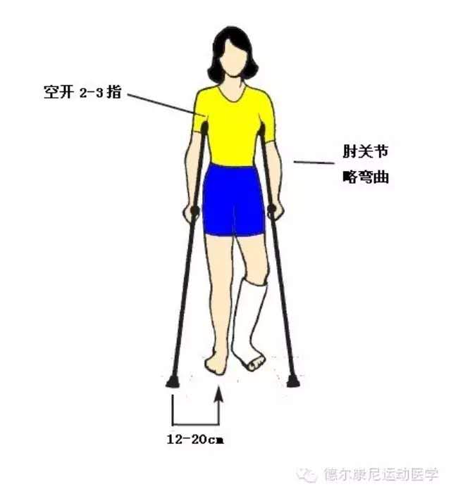 拐杖是一种腿脚受伤时帮助行走的工具