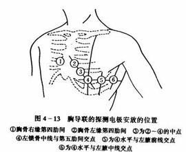 心电图的导联位置