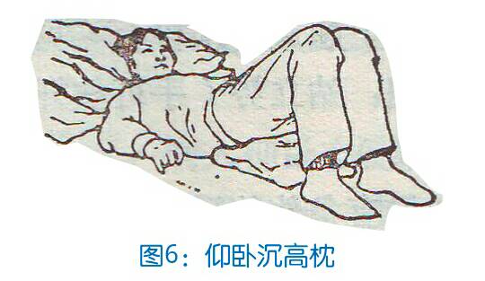 腰突保守康复治疗