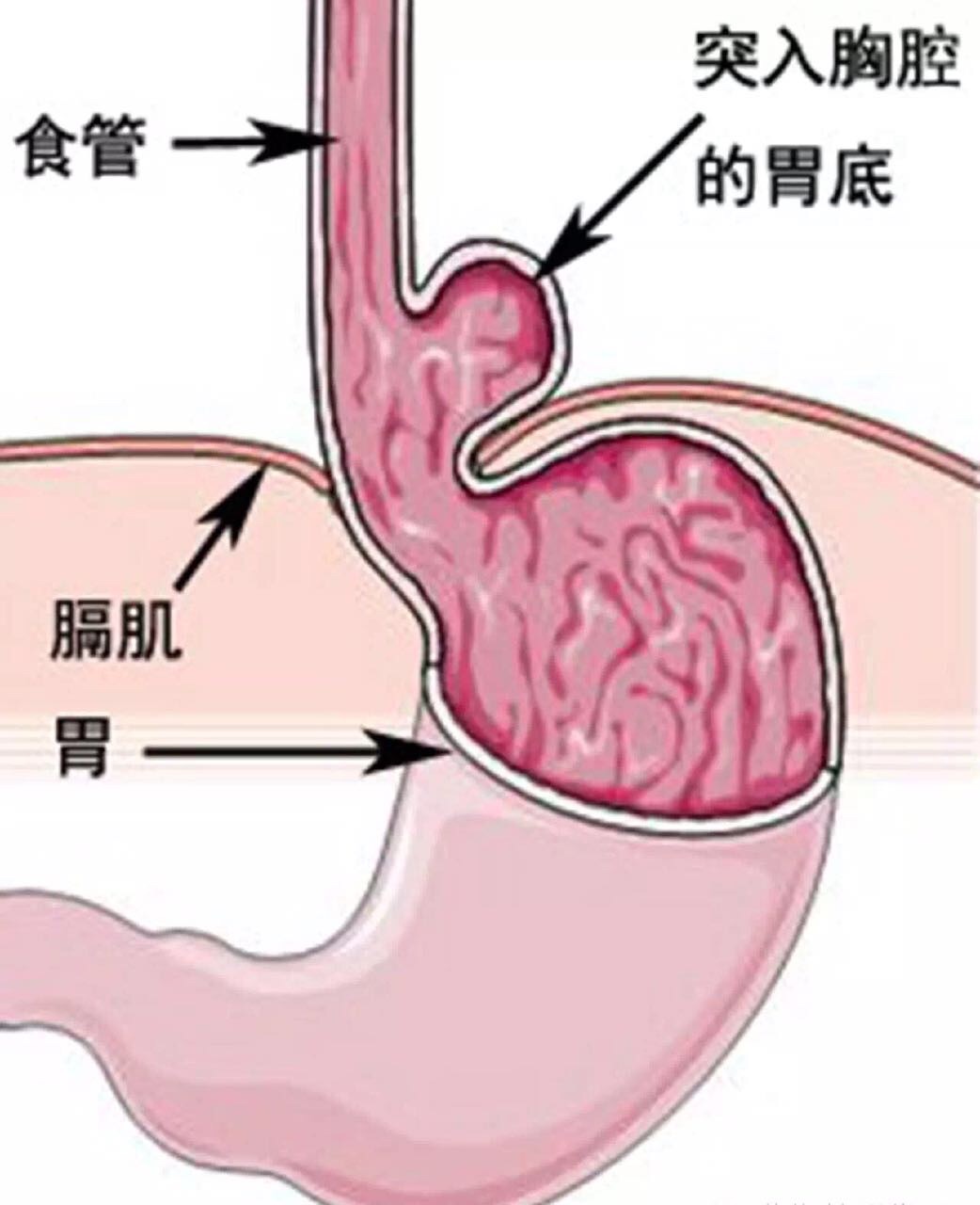 人的食道图片