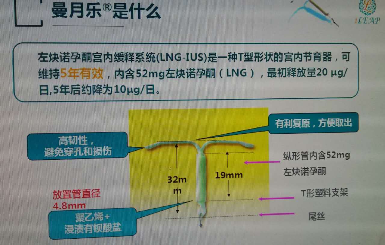 曼月乐环放置时间图片