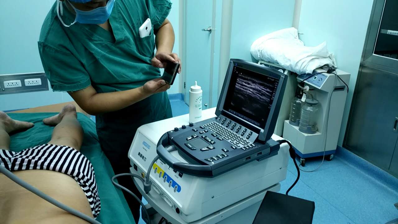 庝痛科精准治疗超声引导下神经疼痛阻滞术