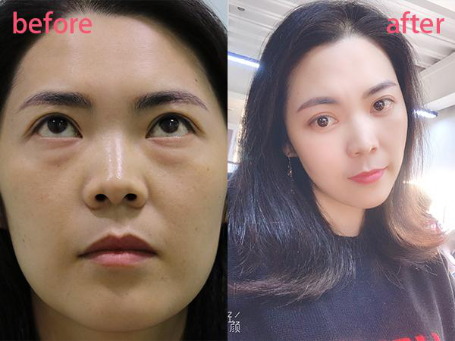 微信截图_20190430114547.png