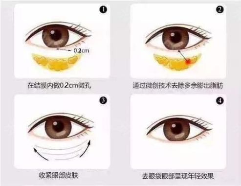 微信截图_20190430114536.png