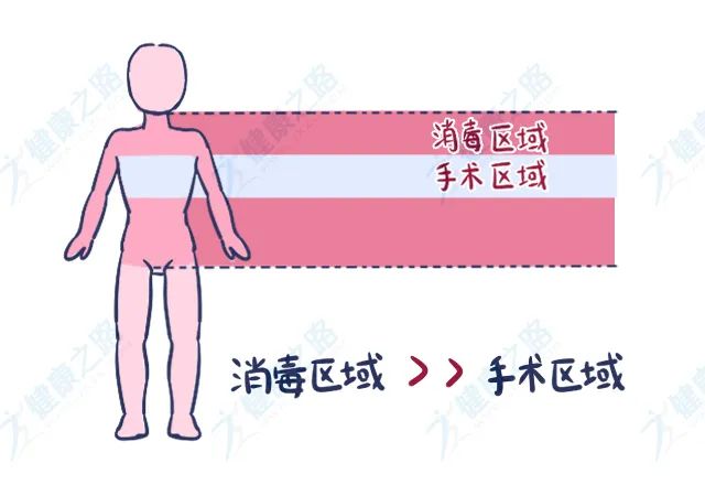 乳房手术消毒范围图片图片