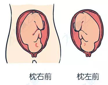 胎儿肩左前位示意图图片
