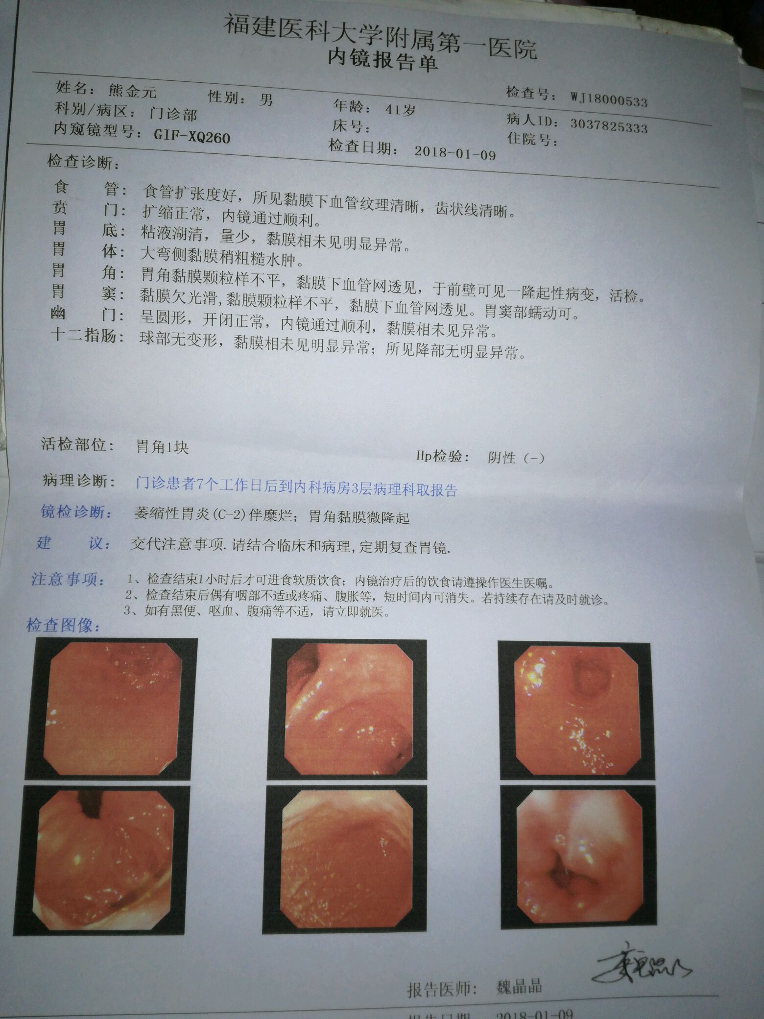 慢性胃炎报告图片